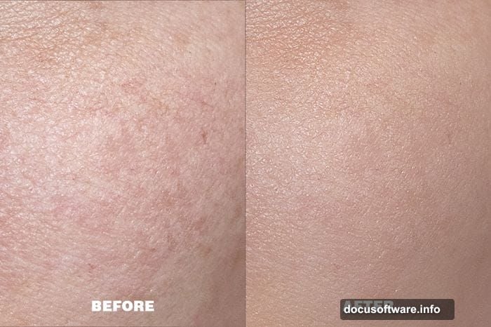 Eye brightening reduces redness in whites while increasing brightness